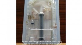 feedingtubekit